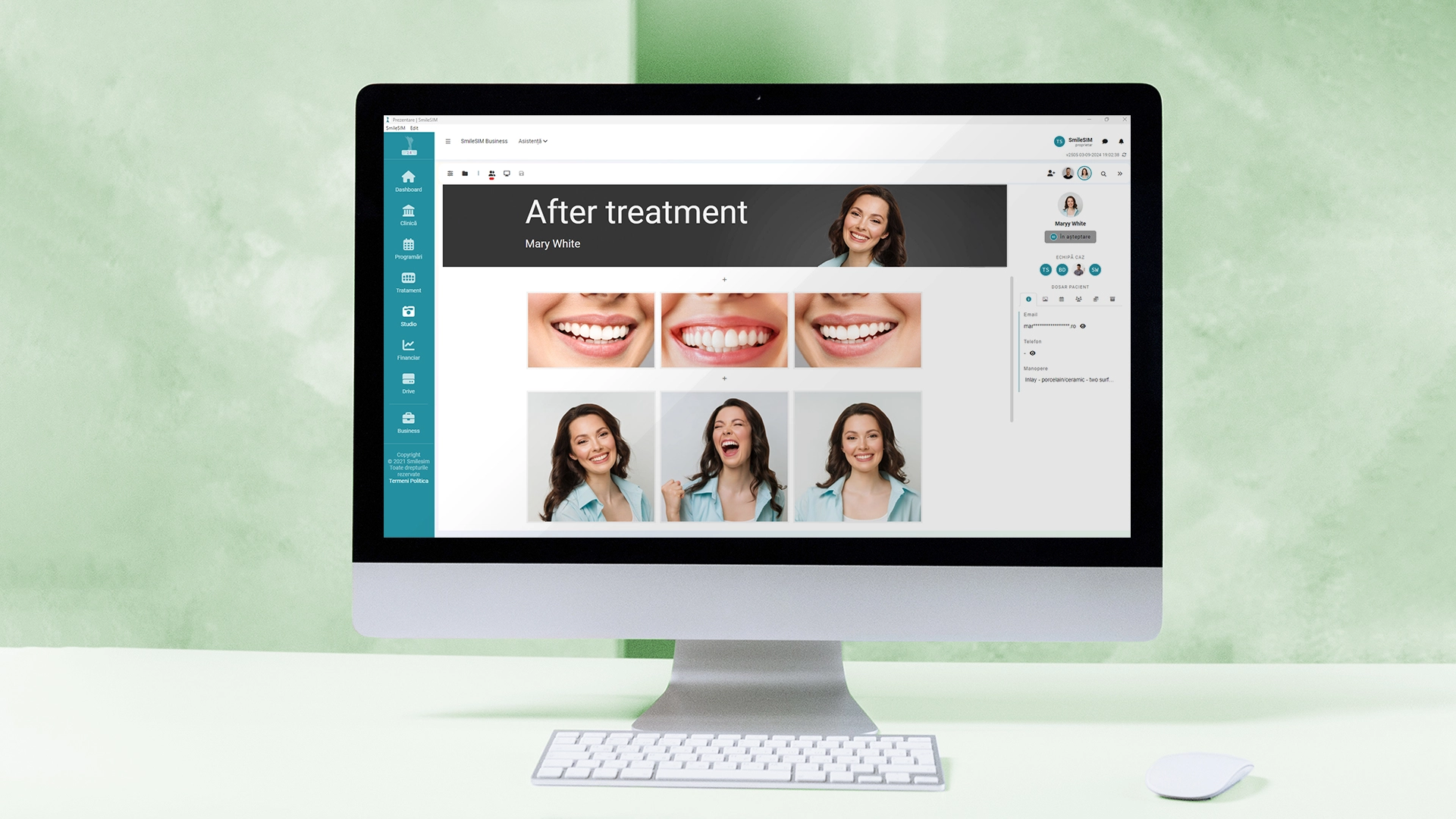 Vista previa de la característica de la aplicación de software del módulo del Estudio